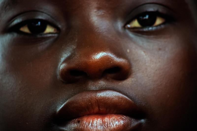 Togo